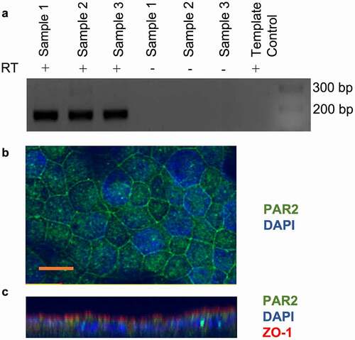 Figure 1. CMT-93 cells express protease-activated receptor 2 (PAR2). A: RT-PCR for PAR2 mRNA expression in CMT-93 cells. Reactions lacking reverse transcriptase enzyme (RT) and template control lacking cDNA were performed as controls. DNA ladder and the sizes (bp) are shown on the right of image, with expected product size being 167 bp (n = 3). B: Confocal immunocytochemistry for PAR2 in CMT-93 cell monolayers (n = 2). Green shows positive immunoreactivity for PAR2 and blue shows DAPI staining for nuclei. C: z stacks of optical sections through cell monolayers. Scale bar represents 10 μm.