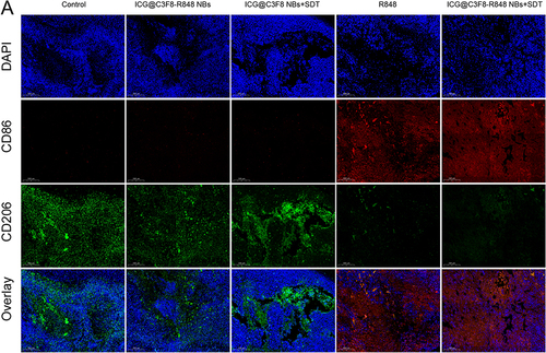 Figure 6 Analysis of immune cells in experimental animals after synergistic sono-immunotherapy. Representative immunofluorescence images of CD86 marker and CD206 marker expressions in the tumor tissues. Scale bars = 200 µm.