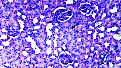 Figure 7 Representative light microscopy of kidney tissue from the control group. Normal kidney tissue. Scale bar 50 µm, H&Ex100.