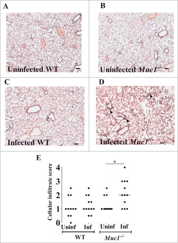 Figure 3. MUC1 prevents lung inflammation in S. pneumoniae infected mice. Representative H&E stained lung photomicrographs in (A) uninfected WT (B) uninfected Muc1−/− (C) infected WT (D) infected Muc1−/− mice. (E) Blinded H&E stained lung sections were graded for cellular infiltration. Infected Muc1−/− displayed significantly higher cellular infiltrate in the lungs as compared with uninfected Muc1−/− mice. (#p < 0.05, Mann-Whitney). Graph presents individual mice (points) and group medians (horizontal bar). Arrows indicate cellular infiltrate. Uninf, uninfected; Inf, infected. Scale bar = 100 µm