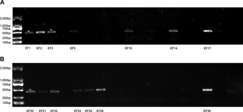 Figure 2 (A) electrophoresis-analysis-of-23srna-resistance-gene-in-40-LNSE-strains. (B) electrophoresis-analysis-of-23srna-resistance-gene-in-40-LNSE-strains.