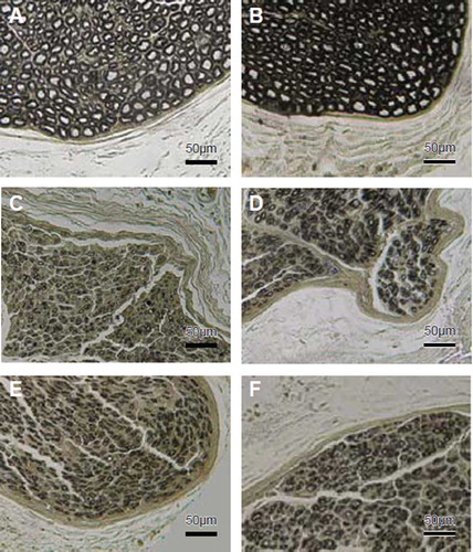 Figure 2. Histological sections through the reconstructed nerves 4 months after surgery. Proximal part of the median nerve (A) and ulnar nerve (B). Distal stump of transected median (C, Dor-Dor, Group 2) or ulnar (D, Dor-Dor Group 3) nerve neurorrhaphy; Distal median (E) and ulnar (F) stump of the group (Dor-Dor+Rec Group 4) in which whole proximal median proximal median nerve was served as donor nerve to reconstruct the distal median and ulnar nerve stump.