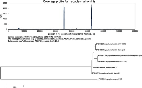 Figure 4 The coverage profile and phylogenetic tree of the M. hominis strain X.