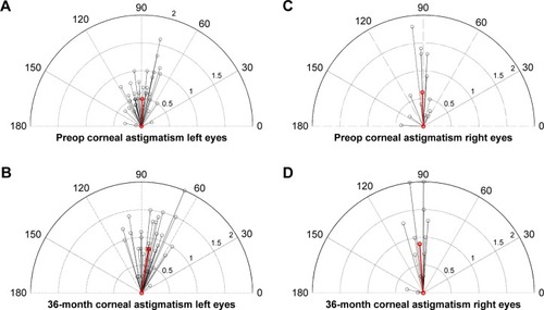 Figure 8 Depictions of corneal astigmatisms and axis for left and right eyes in vector format.
