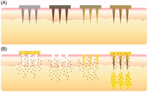 Figure 9. Mechanism of delivery of drugs via microneedles.