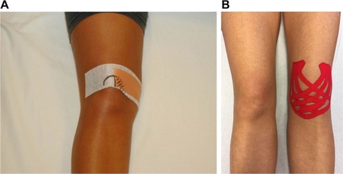 Figure 6 Tape applications for patients with PFP.