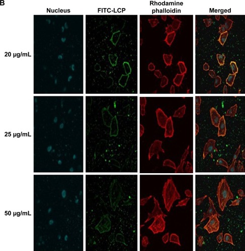 Figure 6 The CLSM images of A549 cells treated with FITC-LCP at various time periods (A) and at various concentrations (B). Magnification ×600.Abbreviations: CLSM, confocal laser scanning microscopy; FITC, fluorescein isothiocyanate; LCP, lipid-coated hollow calcium phosphate.