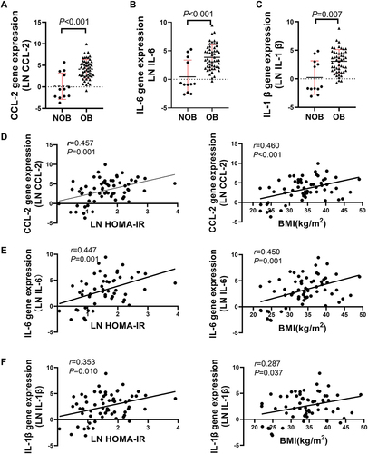 Figure 1 Increased adipose tissue associated CCL-2, IL-6 and IL-1β gene expression in OB group. (A-C) qRT-PCR analysis for CCL-2, IL-6 and IL-1β of omental adipose tissue from NOB and OB groups. (D-F) CCL-2, IL-6 and IL-1β gene expression are respectively positively associated with BMI and Ln(HOMA-IR).