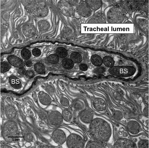 Figure 7. Transmission electron microscopy of Metarhizium brunneum ARSEF 4556 blastospores (BS) in tracheal lumen of Culex quinquefasciatus larva, at 48 hr post-inoculation.