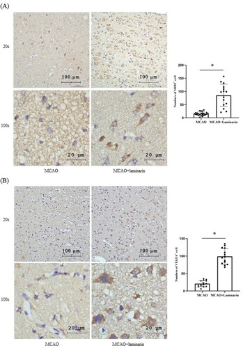 Figure 5. Treatment of laminarin induced the expression of SOD2 and VEGFA in the middle cerebral artery occlusion (MCAO) model. Immunohistochemical (IHC) staining showed the significant induction of (A) SOD2 and (B) VEGFA in the MCAO model. Left panel: the representative picture of IHC staining. Right panel: the result of quantitation of positive stained cells. * Represented the statistically significant, p < 0.05. Number of replicates >20.