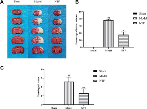 Figure 6 Pretreatment of NTF 7 days prior to CIRI reduced infarct volume and ameliorated neurological deficit in rats 24 h after reperfusion. (A) Representative TTC-stained photos of the cerebral infarct coronal sections. (B) Percentage of infarct volume. (C) Neurological scores. All data were presented as mean ± SD. ##p<0.01 versus sham group; **p<0.01, *p<0.05 versus model group, respectively.