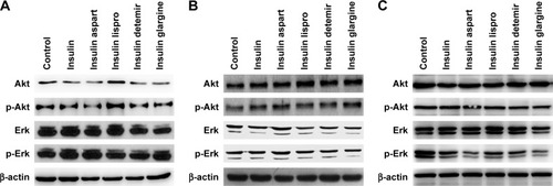 Figure 3 Effects of regular insulin and insulin analogs on PI3K/Akt and MAPK/Erk signaling pathways in PTC cell lines.