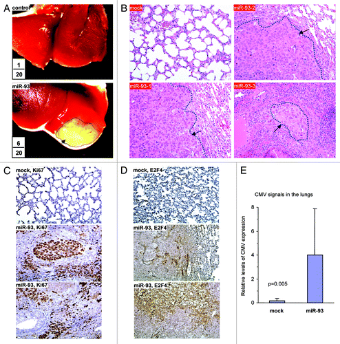 Figure 3. MiR-93 enhanced breast cancer metastasis to the lung. (A) Mock- or miR-93-transfected MT-1 cells (2 × 105) were injected into the tail vein of CD-1 nude mice (n = 20). Six weeks after the injection, six mice in the miR-93 group developed visible tumors in the lungs, but only one in the control group. Typical metastatic lesions in the lungs are shown (arrows). (B) H&E staining of lungs from mock and miR-93 mice showed metastasis lesions in the miR-93 lungs (arrows). (C) The sections were immunohistochemically stained with antibody against Ki67. The miR-93 tumor sections showed higher levels of Ki67 staining than the control group. (D) The sections were also probed with antibody against E2F4. The miR-93 tumor sections showed E2F4 staining, which was not detected in the control group. (E) DNA was isolated from lung tissues and subjected to PCR to amplify the CMV promoter to indicate metastasis of the tissues. Expression of miR-93 promoted metastasis.