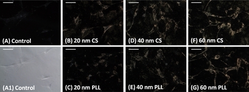 Figure 2 Darkfield images (exposure time 257.3 msec) of mesenchymal stem cells incubated for 24 hours with B) 20 nm citrate-stabilized (CS), C) 20 nm poly-L-lysine (PLL), D) 40 nm citrate-stabilized, E) 40 nm poly-L-lysine, F) 60 nm citrate-stabilized, and G) 60 nm poly-L-lysine media. A) A control darkfield image and A1) phase-contrast image of mesenchymal stem cells not incubated with nanoparticles is shown for comparison. Scale bars 100 μm.