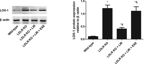 Figure 3. Effect of liraglutide on the LOX-1 expression in the thoracic aorta from LDLR-KO mice and the role of exendin-9. LIR indicates liraglutide. EXE indicates exendin-9. The results of three independent experiments were expressed as mean ± SE. *P < 0.05 compared to wild-type mice, #P < 0.05 compared to LDLR-KO mice, &P < 0.05 compared to liraglutide-treated LDLR-KO mice.