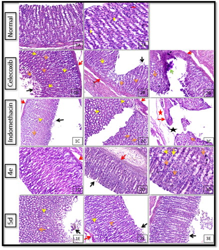 Figure 5. Effects of celecoxib, indomethacin, and the highest selective compounds 4e and 5d on the stomach histology (H & E X 400 & 200).