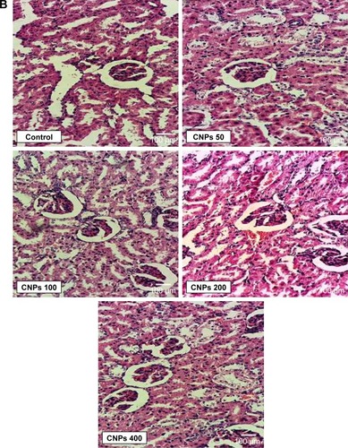 Figure 1 (A, B) Histopathological findings in liver and kidney of male Wistar rats after treatment with CNPs for 14 days (H&E, 400×).Abbreviation: CNPs, cerium oxide nanoparticles.