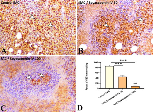 Figure 8. Ki-67 immunoexpression within Ehrlich’s carcinoma solid tumor. EAC group showing marked nuclear expression within the entire mass (A), treated groups with Soyasaponin IV (50 and 100 mg/kg) (B and C respectively) revealing dose-dependent decrease of Ki-67 expression within the mass. Quantitative scoring of Ki-67 within the mass (D). ***P < 0.001 vs. EAC control group, ##P < 0.001 vs. Soyasaponin IV (100 mg/kg) treated group.