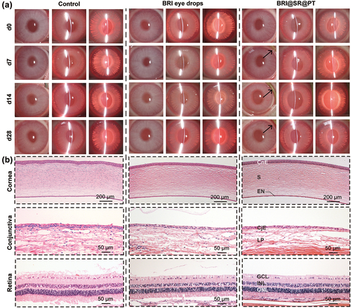 Figure 7. (a) Representative photographs of the anterior segments of rabbit eyes in the control, BRI eye drops (0.15% w/w), and BRI@SR@PT groups. Three kinds of slit lamp modes including diffuse illumination, direct focal illumination, and retro-illumination were used for the examination of the anterior segments of rabbit eyes. The BRI@SR@PTs administered in the conjunctival sacs of rabbit eyes were marked with black arrows. (b) Representative H&E staining images of cornea, conjunctiva, and retina in three groups. CnE, corneal epithelial layer; CjE, conjunctival epithelial layer; S, stroma; EN, endothelial layer; LP, lamina propria; GCL, ganglion cell layer; INL, inner nuclear layer; ONL, outer nuclear layer.