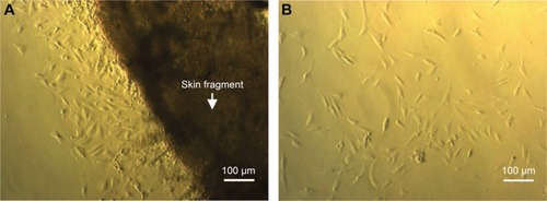 Figure 1 Isolation of fibroblasts from skin tissue.