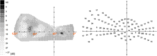 Figure 1 Extent of the nasal part of the visual field of the healthy right eye.