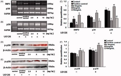 Figure 6. The effect of SPC-I on the expression of BMP2 and p38-MAPK.