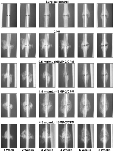 Figure 2 Postoperative radiographic appearance of the nonhuman primate fibular osteotomy sites that were untreated, treated with calcium phosphate matrix (CPM), and treated with 0.5, 1.5, and 4.5 mg/mL rhBMP-2/CPM administered 1 week after surgery. Reproduced with permission from CitationSeeherman H, et al 2006a. rhBMP-2/calcium phosphate matrix accelerates osteotomy-site healing in a nonhuman primate model at multiple treatment times and concentrations. J Bone Joint Surg Am, 88:144–60. Copyright © 2006. The Journal of Bone and Joint Surgery, Inc.