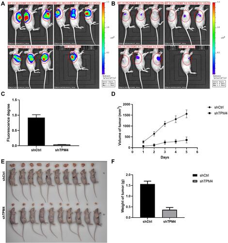 Figure 4 Knockdown of TPM4 inhibited the xenograft growth in nude mice. (A) Whole-body fluorescent imaging system showed the size of tumor in nude mice of the control group. (B) Whole-body fluorescent imaging system showed the size of tumor in nude mice of the TPM4 knockdown group. (C) The fluorescence degree of the tumor. (D) The tumor volume of shCtrl and shTPM4 mice. (E) The mice were sacrificed and the tumors were isolated. (F) The weight of the isolated tumor of the two groups (n=10). Data were presented as the mean±SD.