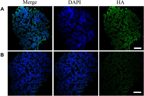 Figure 6 HA-stained cryosections of spheroids in the HAase-untreated group (A) and HAase-treated group (B). HAase-treated spheroids were exposed to NPs/HAase combined with 0.5 mg/mL of HAase for 8 hours before sectioning and staining. HA stain was showed in green and the nuclear stain, DAPI, was shown in blue. Scale bar represents 100 μm.