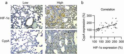Figure 1. Expression of cypA and HIF-1α in NSCLC carcinoma specimens. (A) Increased and decreased expression levels of HIF-1α and cypA on NSCLC specimen sections. (B) Relationship between cypA expression and HIF-1α expression. Spearman’s correlation = 0.346, p <0.0001.