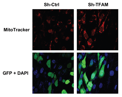 Figure 8 TFAM-deficient fibroblasts increase mitochondrial activity in adjacent cancer epithelial cells. We co-cultured sh-TFAM and sh-Ctrl fibroblasts with GFP-tagged MDA-MB-231 breast cancer cells. Then, we visualized mitochondrial activity in these co-cultures using MitoTracker. Note that TFAM-fibroblasts specifically increase the mitochondrial activity of adjacent MDA-MB-231 cells. MitoTracker (red); epithelial cancer cells/GFP (green); nuclei/DAP I (blue). See online version for color version of the figure.