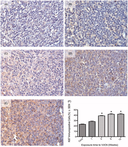 Figure 1. Effect of inhaled vanadium on percentage of Ki-67 immunopositive lymphocytes in male mice. Representative figures are presented. (A) Control mouse spleen shows slight signal to Ki67, mainly in the nucleus. Ki-67 signal increases with exposure time – after 1, 4, 8 and 12 weeks of exposure – as shown in, respectively (B, C, D and E). The signal in exposed groups is apparent both in the nucleus and cytoplasm. (F) The increase in lymphoproliferation was significant after 4 weeks and then until the end of exposure (*p < 0.05 ANOVA, Tukey’s post-hoc test).