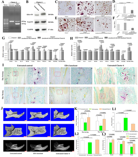 Figure 4 Effects of EDA knockout Cluster 4 on osteoclastogenic induction. (A) PCR product bands from EDA knockout fibroblasts of Cluster 4 (415 bp) and untreated cells (675 bp). (B) The protein levels of EDA+FN and total FN in EDA knockout and untreated cells were detected by Western blot analysis. (C) The Trap+MNCs induced by fibroblasts of Cluster 1 alone and Cluster 1 cocultured with Cluster 4 or EDA knockout Cluster 4. (original magnification of ×200, scale bar = 50 μm). (D) Comparison of osteoclastogenic induction among the differently cultured Cluster 1 fibroblasts. (*P < 0.05). (E) Trap+MNCs induced by fibroblasts of Cluster 3 alone and Cluster 3 cocultured with Cluster 4 or EDA knockout Cluster 4 (original magnification of ×200, scale bar = 50 μm). (F) Comparison of osteoclastogenic induction among differently cultured Cluster 3 fibroblasts. (**P < 0.01). (G) Relative expression of osteoclastogenesis-related genes in differently cultured Cluster 1 fibroblasts. (*P < 0.05; **P < 0.01). (H) Relative expression of osteoclastogenesis-related genes in differently cultured Cluster 3 fibroblasts. (*P < 0.05; **P < 0.01). (I) In experimental periodontitis, osteoclasts in the furcation area on Days 3 and 7 after ligature placement, including the control and EDA knockout cell groups. (J) Micro-CT-based analyses of remaining bone volume in the furcation area and alveolar bone loss (scale bar = 1 mm). (K) Comparison of the number of osteoclasts in the furcation area on Days 3 and 7 among groups. (*P < 0.05; **P < 0.01). (L1–L3) Micro-CT-based quantification of the bone volume at the furcation area, alveolar bone loss area, and depth. (*P < 0.05; **P < 0.01).