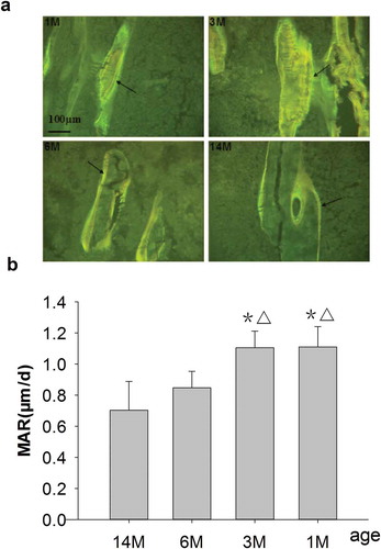 Figure 3. (a) Representative double-fluorescence micrographs of PTM in rats of different ages (undecalcified sections, 8 μm, 20×). 1M: 1 month old, 3M: 3 months old, 6M: 6 months old, 14M: 14 months old. A wider and longer double-fluorescence interval as well as an obvious yellow and green fluorescent strip could be seen in both 1- and 3-month-old rats, and these were narrower and shorter for 6-month-old rats and narrowest and shortest for 14-month-old rats. Arrows point to double fluorescence after fluorochrome labeling with tetracycline hydrochloride and calcein. Quantitative measurements of double fluorescence are shown in Figure 3b. (b) Changes of MAR in rats of different ages. Data are expressed as means ± SD (n = 6) in each group. MAR was significantly increased in 1- and 3-month-old rats vs. 6- and 14-month-old rats, respectively, and there were no differences for 6-month-old rats vs. 14-month-old rats. Vs. 14-month-old, *P < 0.01; vs. 6-month-old, ▵P < 0.01, Student’s t-test. PTM, the proximal tibial metaphyses; MAR, mineral apposition rate; 1M: 1-month-old, 3M: 3-month-old, 6M: 6-month-old, 14M: 14-month-old.