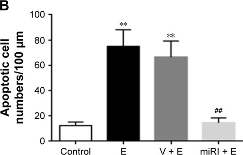 Figure 3 miR-210 inhibitor prohibited epilepsy-induced neuronal apoptosis.