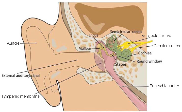 Figure 1. Normal ear structure.The ear is divided into outer ear, middle ear and inner ear. The outer ear consists of the outer auricle and the outer auditory canal. The tympanic membrane is located between the outer ear and the middle ear, containing the tympanum and the auditory ossicle, with the latter composed of three bones, that is, the malleus, the incus and the stapes. The inner ear is mainly composed of labyrinths, including membranous labyrinths and bony labyrinths, which are both filled with lymphatic fluid and are divided into the vestibule, semicircular canal, cochlea and inner ear canal.