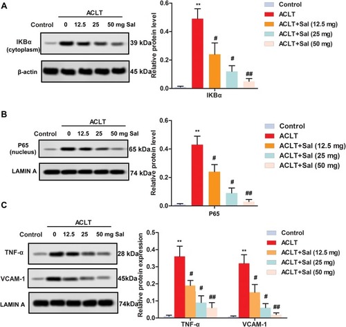 Figure 5 Sal ameliorated cartilage injury by the regulation of NF-κB pathway in OA rats. Rats were divided into five groups (n=10): Control group (Healthy rats were given saline treatment); ACLT, ACLT model; ACLT + Sal (12.5 mg/kg), OA rats were treated with 12.5 mg/Kg Sal; ACLT + Sal (25 mg/Kg), OA rats were treated with 25 mg/kg Sal; ACLT + Sal (50 mg/kg), OA rats were treated with 50 mg/Kg Sal. (A–C) Levels of IKBα, p65, TNF-α and VCAM-1 were measured by Western blotting. (A) IKBα level. (B) p65 level. (C) Levels of TNF-α and VCAM-1. β-actin and Lamin A were employed as an internal reference, respectively. (**P < 0.01 vs control group, #P < 0.05, ##P < 0.01 vs ACLT group).