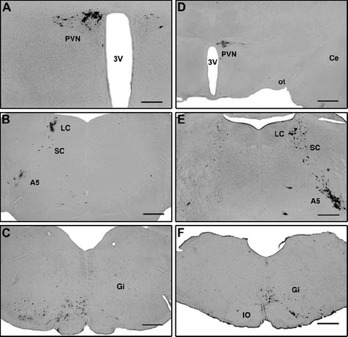 Figure 3 Unilateral (right side) spino-medullary hemisection, ipsilateral (right side) viral injections into the hindlimb (A–C). Four/five days after inoculation, infected cells appear only on the contralateral (left) side in the hypothalamic paraventricular nucleus (A), the pons (B) and the rostral medulla oblongata (C). Unilateral (left side) spino-medullary hemisections, contralateral to viral injection into the right hind limb (D–F). Four/five days after inoculation, infected cells appear only on the side of the injection (right) in the hypothalamic paraventricular nucleus (D), the pons (E) and the rostral medulla oblongata (F). Abbreviations: A5, A5 noradrenaline cell group; Ce, central amygdaloid nucleus; Gi, gigantocellular reticular nucleus; IO, inferior olive; LC, locus coeruleus; ot, optic tract; PVN, paraventricular nucleus; SC, subcoeruleus area; 3V, third ventricle. Scale bars = 500 μm (A) and 1 mm (B–F).