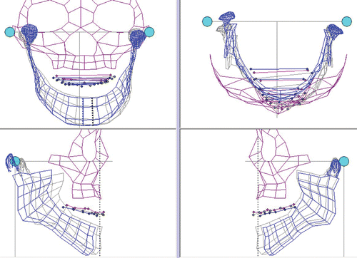 Figure 8. Pilot surgical simulation. [Color version available online.]