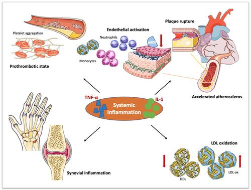 Figure 1 Pathogenetic links between systemic and cardiovascular inflammation. Proinflammatory cytokines, such as tumor necrosis factor-alpha (TNF-α) and interleukin-1 (IL-1), upregulated in the setting of systemic inflammation, trigger endothelial activation. The ensuing overexpression of endothelial leukocyte adhesion molecules leads to increased recruitment and activation of inflammatory cells within the arterial wall, resulting in destabilization of endothelial hemostasis, endothelial dysfunction and vascular inflammation. The heightened synthesis of potent procoagulant molecule tissue factors by activated endothelial cells induces platelet adhesion and aggregation, creating a prothrombotic state. Moreover, systemic inflammation associates with an increase in oxidized low-density lipoprotein (LDL-ox) particles along with a reduction in high-density lipoprotein (HDL). These inflammation-driven mechanisms are responsible for the derangement of vascular architecture which represents the earliest step of atherosclerosis, ultimately resulting in vulnerable plaque formation and rupture.