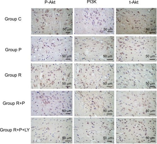 Figure 4 The expressions of p-Akt, PI3K, and t-Akt in five groups (five for each) were detected by immunohistochemistry.