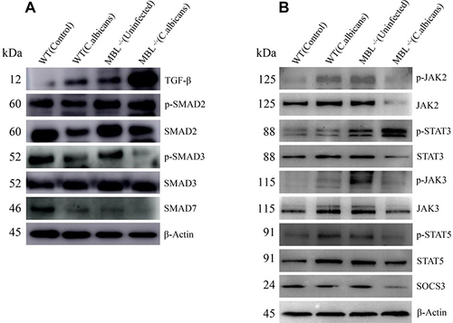 Figure 4 MBL acts through the JAK/STAT and TGF-β/SMAD signaling pathway in C. albicans-infected mice. The protein expression of (A) TGF-β, p-SMAD2/3, SMAD2/3, SMAD7, (B) p-JAK2/3, p-STAT3/5, JAK2/3, STAT3/5, and SOCS3 in splenocytes was determined by western blot. Representative images from one of three independent experiments are shown.