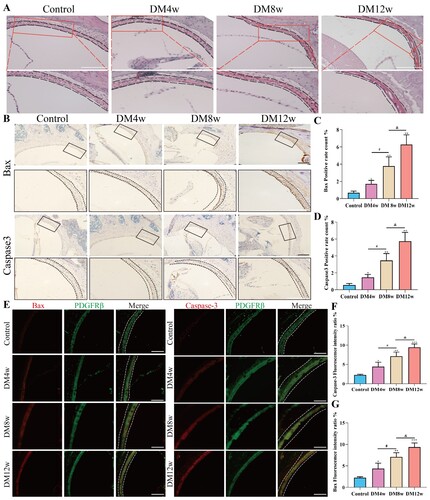 Figure 3. Diabetes induced cochlear stria vascularis injury and increased pericytes apoptosis in C57BL/6J mice. A: HE staining of cochlear stria vascularis in each group, Scale bar = 50 μm; B: B: Representative images of immunohistochemistry for Bax and Caspase-3 in the cochlear stria vascularis of each group, Scale bar = 50 μm; C: Statistical results of Bax expression levels in the cochlear stria vascularis, n = 5 mice per group, One-way Anova with Turkey’s post-hoc test, *P < 0.05, **P < 0.01 vs Control, #P < 0.05 vs DM4w group, &P < 0.05 vs DM8w group; D: Statistical results of Caspase-3 expression levels in the cochlear stria vascularis, n = 5 mice per group, One-way Anova with Turkey’s post-hoc test, *P < 0.05, **P < 0.01 vs Control, #P < 0.05 vs DM4w group, &P < 0.05 vs DM8w group; E: Representative images of co-labeling of PDGFR-β, Bax, and Caspase-3 in the cochlear stria vascularis pericytes, Scale bar = 50 μm; F: Statistical results of Bax expression levels in the cochlear stria vascularis pericytes, n = 5 mice per group, One-way Anova with Turkey’s post-hoc test, *P < 0.05, **P < 0.01, ***P < 0.01 vs Control, #P < 0.05 vs DM4w group, &P < 0.05 vs DM8w group; G:Statistical results of Caspase3 expression levels in the cochlear stria vascularis pericytes, n = 5 mice per group, One-way Anova with Turkey’s post-hoc test, *P < 0.05, **P < 0.01,***P < 0.001 vs Control, #P < 0.05 vs DM4w group, &P < 0.05 vs DM8w group. Data are presented as the means ± SEMs.