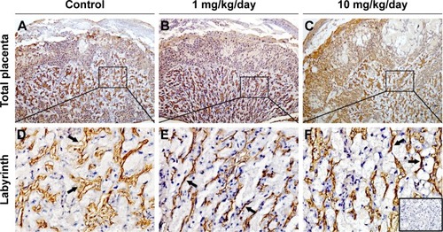 Figure 6 Effect of TiO2 NP treatment on the labyrinth vascularization of placenta.Notes: (A–C) Laminin immunohistochemical staining of mice placentas treated by control (A), 1 (B) and 10 mg/kg/day (C) TiO2 NPs. Boxed areas in A–C were imaged with four-times higher magnification (D–F, respectively). Inset of F shows immunostaining of a negative control-stained section (primary antibody was replaced by normal rabbit serum). Black arrows show fetal vessels.Abbreviation: TiO2 NPs, titanium dioxide nanoparticles.