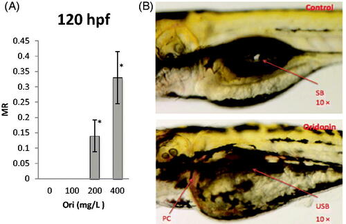 Figure 4. Effects of oridonin on malformation for zebrafish embryo-larvae. Note: Asterisks indicate statistically significant differences between different concentration of oridonin groups and the without oridonin group (*p < 0.05). Each error bar represents the standard deviations of at least three experiments. MR: Malformation Rate; Ori: Oridonin; PC: Pericardial Congestion; USB: Uninflated Swim Bladder; SB: Swim Bladder.