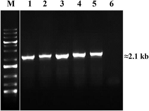 Figure 3. PCR amplification of fenA gene encoding fengycin synthetase A. Designations: M, molecular weight marker (Perfect PlusTM 1 kb DNA Ladder, EURx); 1, B. velezensis R7; 2, B. amyloliquefaciens R10; 3, B. velezensis R19; 4, B. velezensis R22; 5, B. velezensis R23; 6, negative control (E. coli DH5α).