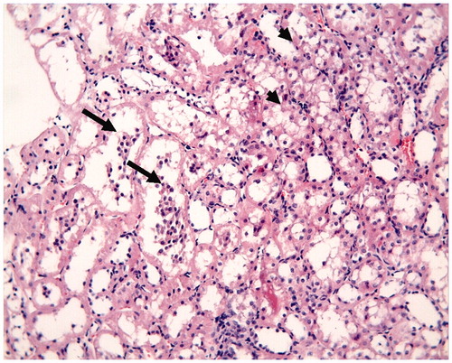 Figure 2. I/R group: degeneration of tubular epithelium (hydropic degeneration (small arrow) in the tubules and cell desquamation (great arrow), H–E; ×20.