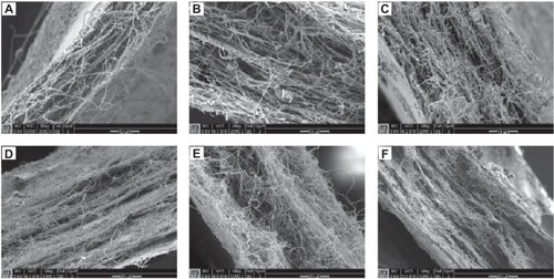 Figure 6 Cross-sectional scanning electron micrographs of electrospun fabrics. Samples were cryo-fractured using liquid nitrogen to achieve a clean break, and then imaged to observe microarchitectural differences in the z-plane. (A) PVA only, (B) LNG-only, (C) TFV-only, (D) stacked, (E) interwoven, and (F) combined images of composite fabrics.Notes: Images A–C have a scale bar of 10 μm. Images D–F have a scale bar of 20 μm.