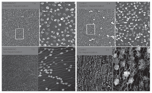 Figure 5 SEM pictures of first generation NO-releasing ECC with magnification of the outlined area adjacent. (1a and b) represent the MAHMA/NO doped circuits with and without systemic heparinization, while (2a and b) represent the controls with and without systemic heparinization. Note the dysmorphic platelets seen when systemic heparinization is present and the scarcity of platelet adherence and activation in the presence of an NO-releasing ECC.