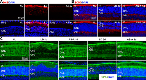 Figure 8 AS-A alleviates bright light-induced retinal oxidative stress. Dark-adapted BALB/c mice were treated with vehicle (LD) or AS-A at 100 mg/kg bw (AS-A) 30 min prior to bright light exposure. Dark-adapted BALB/c mice without bright light exposure received vehicle treatment (NL). (A) DHE was administered at 20 mg/kg bw through intraperitoneal injection 1 d after bright light exposure. Eye cups were made from the eyeballs enucleated 2 h after DHE injection, followed by cryosectioning and in situ examination of retinal ROS production. ROS signals (in red) and DAPI positivity (in blue) were examined by a fluorescence microscope (n=6 per group). (B and C) Eyeballs from the indicated treatment groups were collected 1 d and 3 d after bright light exposure. IHC examination of SOD2 (in red) (B), GPX4 (in green) (C) was then performed (n=5-6 per group). DAPI (in blue) was counterstained. White asterisks point to diminished GPX4 in the IS (C).